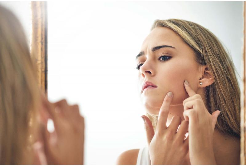 Dermatoloog: “Wat is eigenlijk acne? En wat kan ik er tegen doen?”