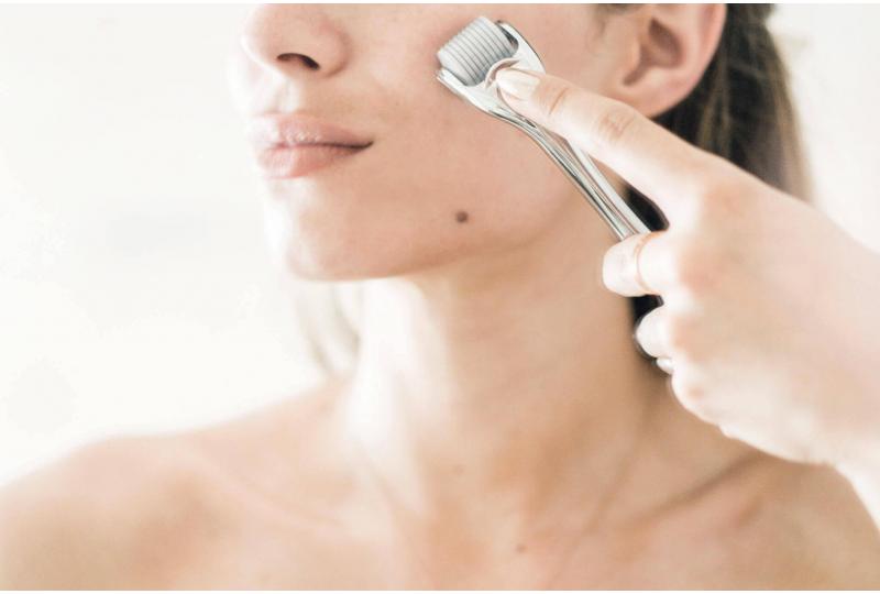 What is microneedling? And why is everyone talking about it?